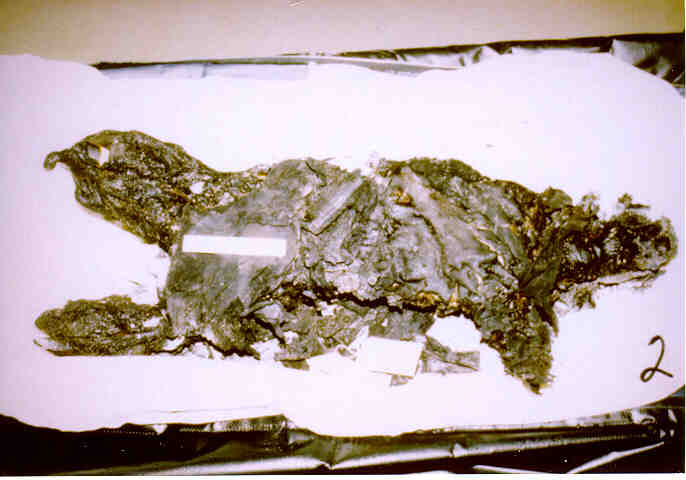 Carmel Doe 2 Autopsy photograph of the alleged remains of Malcolm Livingsto...